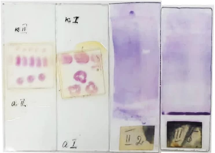 Stained specimens on microscope slides